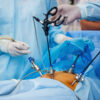 Operation,Using,Laparoscopic,Equipment