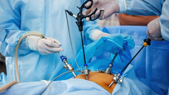 Operation,Using,Laparoscopic,Equipment